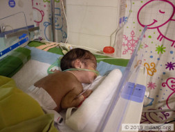 Baby of Pooja needs your help to survive