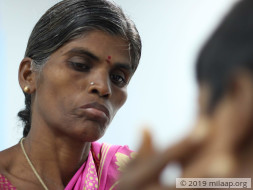 Help Bhavi Shree Fight Acute Promyelocytic Leukemia