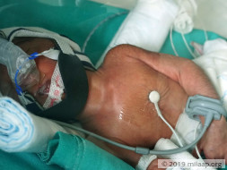 Help Mamatha's Premature Baby