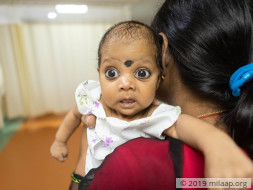 Help Baby of Namasvi Undergo AV Canal Defect Repair Surgery