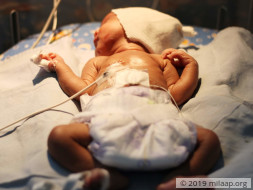 Help Baby of Rupabai Recover From Severe Dyselectrolytemia