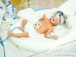 Baby of Teeja needs your help to survive