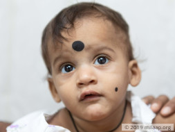 Help Aravind Naik Undergo A VSD Closure Surgery