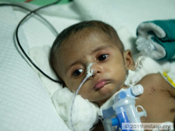 Help Baby of Haritha Rani Undergo VSD Closure