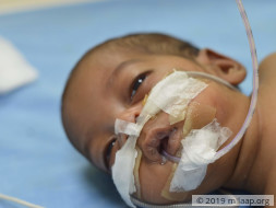 Help Baby of Priyanka Survive