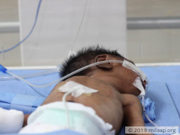 Help Baby of Saranya Recover