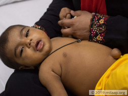 Misam Mohammed needs your help to undergo Liver Transplant