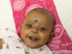 Help Priyangshu Debnath Fight Biliary Atresia