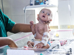 Abu Talha needs your help to undergo his treatment