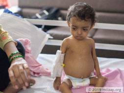 Harshita Kajrolkar needs your help to undergo Liver transplant