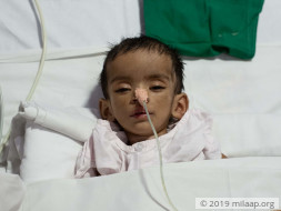 Help Aastha Singh Recover From Neonatal Encephalopathy