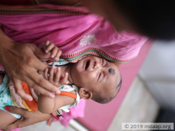 Help Tanushree Barman Undergo A Cardiac Surgery