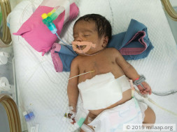 Help Baby of Fathima Ahmed Survive