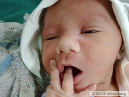 Help My 2 Week Old Son Survive