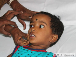 Help Nehasree Recover From Positive Glioma