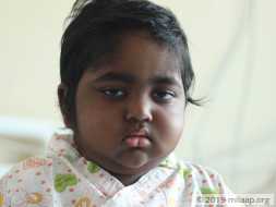 Help Rushikesh Fight HLH