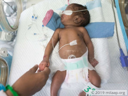 Help My Premature Baby Recover