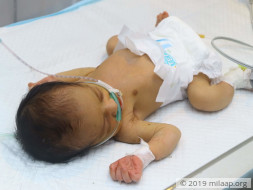 Help Sarina's Baby Recover