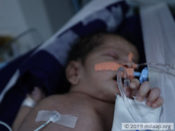 Help Ruksar's Baby Recover From Pulmonary Hemorrhage