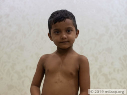 Help Aris Khan Fight Congenital Heart Disease