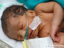 Help Arti's Preterm Baby Survive