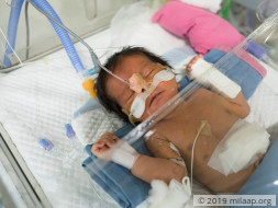 Help Swathi's Preterm Baby Survive