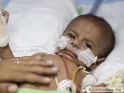 My 2 month old baby is battling for his life in the ICU