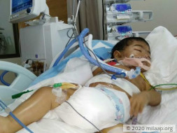 At 10 Months, Aizen's Survival Depends On An Urgent Liver Transplant