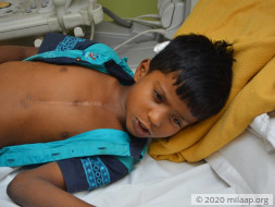 Help 7-year-old Gokul fight a severe heart disease