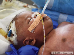 Help Ambika save her premature baby