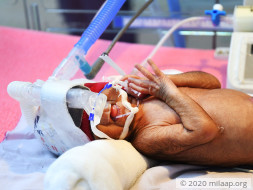 Help Kamala and Kallan save their premature twins