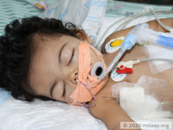 Baby Girl Who Can't Eat Or Breathe Needs Urgent Help To Live