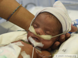 15 days old baby of Shilpi needs your help to survive