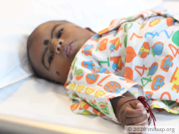 This 9-Month-Old Baby Is Running Out Of Time To Get A Heart Surgery