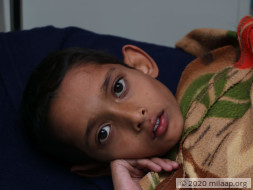 A Cancerous Tumour Has Been Growing In This Boy’s Body For 5 Years
