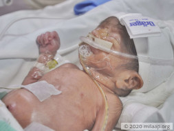 Baby of Latha needs your help to survive