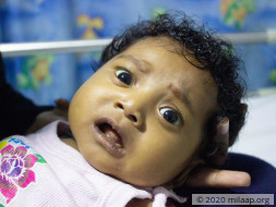 Baby Keerti Murikipudi needs your help!