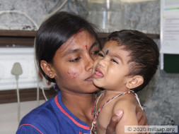 His First Steps Revealed His Deformed Spine, Needs Urgent Surgery