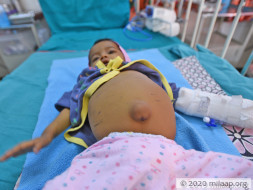 Prisha Malvadkar needs your help to undergo Liver transplant