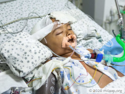 Help Aradhya Undergo An Urgent Decompressive Craniotomy