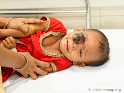 Ashia Parveen needs your help to undergo his treatment