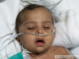 Help Baby of Chandra Shakar Recover From Pneumonia