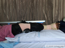 Help V Prabhavathi Recover From Synovinal Sarcoma Of Right Knee