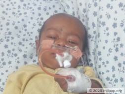Help Amala's Baby Fight Infantile Dengue With Severe Pneumonia