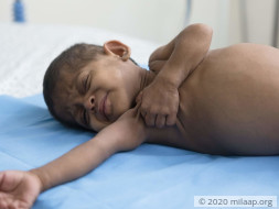 Help Zaina Begum Fight Chronic Liver Disease