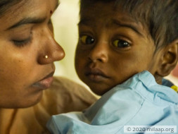 Help Guru Saran Recover From Decompensated Liver Cirrhosis