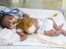 Help Marutha's Baby Recover