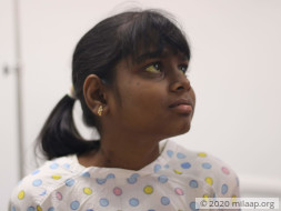 Help Sakshi Undergo A Liver Transplant