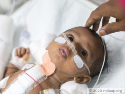 Help Baby of Mamatha Fight Congenital Heart Disease