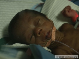 Help Our Twin Babies Recover